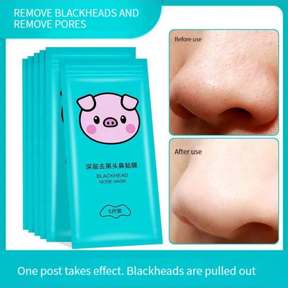 Tira nasal removedora de cravos 5 peças, removedor de acne mágico, poderoso removedor de ácaros, limpeza profunda, redução de poros, pele lisa
